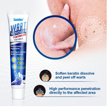 1PC Warts Remover Antibacterial Ointment Wart Treatment Cream Skin Tag Remover Herbal Extract Corn Plaster
