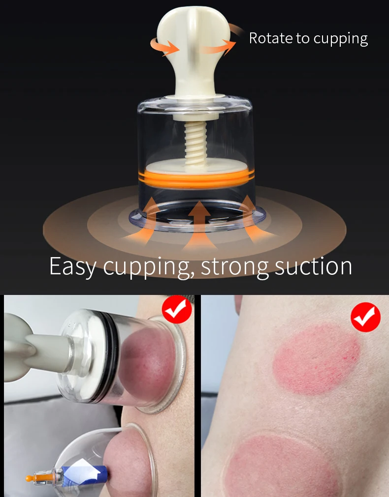 1PC Manual Rotating Cupping Vacuum Cupping Device Breast Nipple Sucker Body Massager Vacuum Suction Cup Anti Cellulite Massager 2