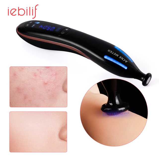 Plasma Pen Scar Acne Spot Removal Anti Wrinkle Aging Therapy Blue Light