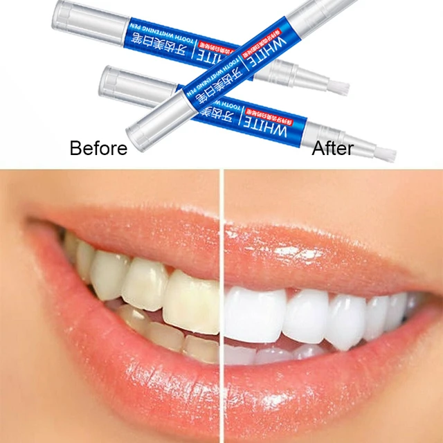 1Pcs Natural Teeth Whitening Gel Pen Oral Care Remove Stains Tooth Cleaning Oral Hygiene Care Teeth