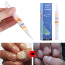 Жидкая ручка для лечения грибковых ногтей, яркие ногти, ремонт пальцев и пальцев ног, онихомикоз, эссенция для удаления ухода за ногами