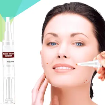 

3ml Effective Skin Tag Remover Pen Skin Repair Pen Foot Remover Remover Skin & Tag Mole Corn Kill Medical Wart Liquid Genit U1M1