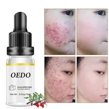 Oligopeptide Placenta Cream Acne Skin Care Repair Whitening Anti-wrinkle Anti-wrinkle Essence Moisturizing Serum Face Oil