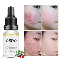Oligopeptide Placenta Cream Acne Skin Care Repair Whitening Anti-wrinkle Anti-wrinkle Essence Moisturizing Serum Face Oil