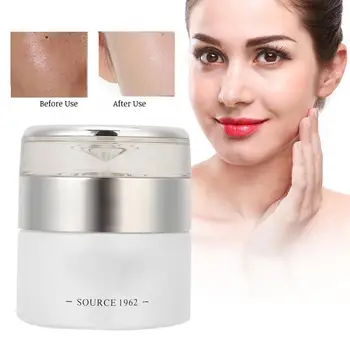 

30ml Freckles Cream Face Whitening Brightening Cream Spots Freckles Removal Skin Care Serum