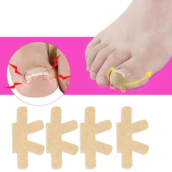 

4 Pcs Ingrown Toenail Corrector Stickers Straightener Strips Pedicure Tool Thick Correction Patch Foot Care