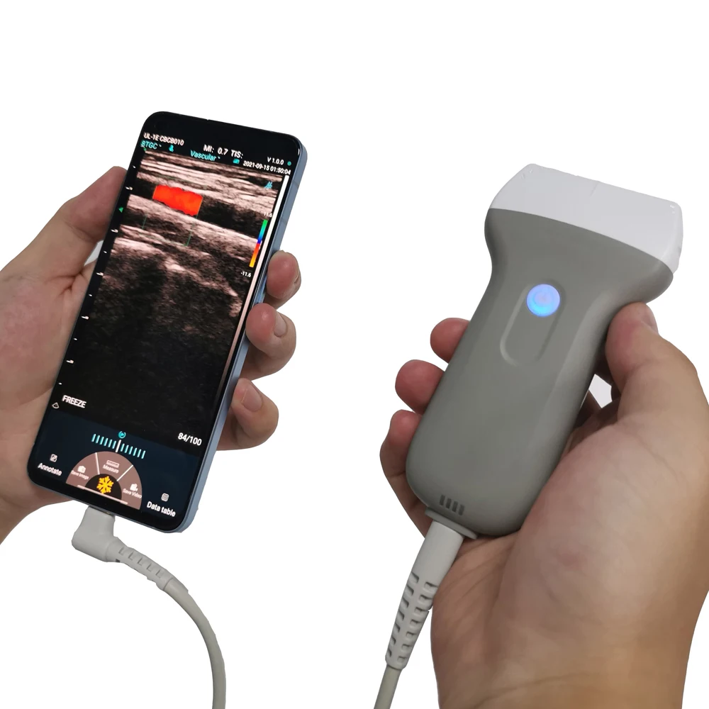 Abdomen Cardiac Kidney Vascular、carotid Handheld Ultrasound Convex