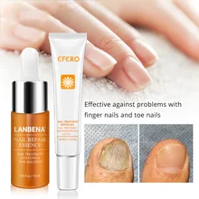 Лечение грибка ногтей, восстанавливающий крем для ногтей, анти-инфекция, уход за ногами, сыворотка для защиты ногтей, крем, онихомикоз, эссенция для удаления