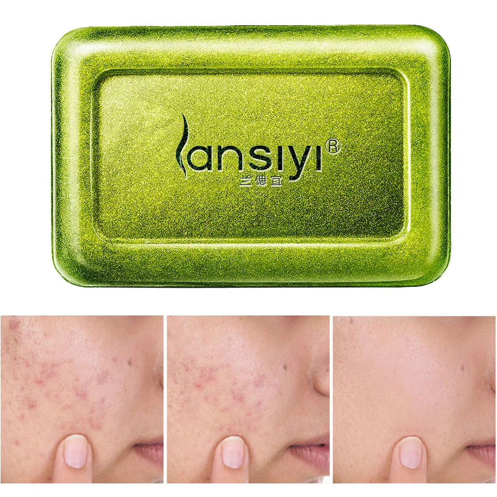 

Manual Soap Cleaner Removal Pimple Tea Tree Moisturizing Soap Skin Care 100g