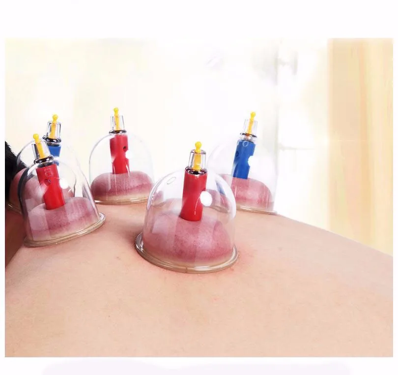 Cofoe 24pcs cupping set Ventosa Vacuum suction cup Body Massager Chinese Medical Cold& Flu Relief massage cups damp toxin Clear