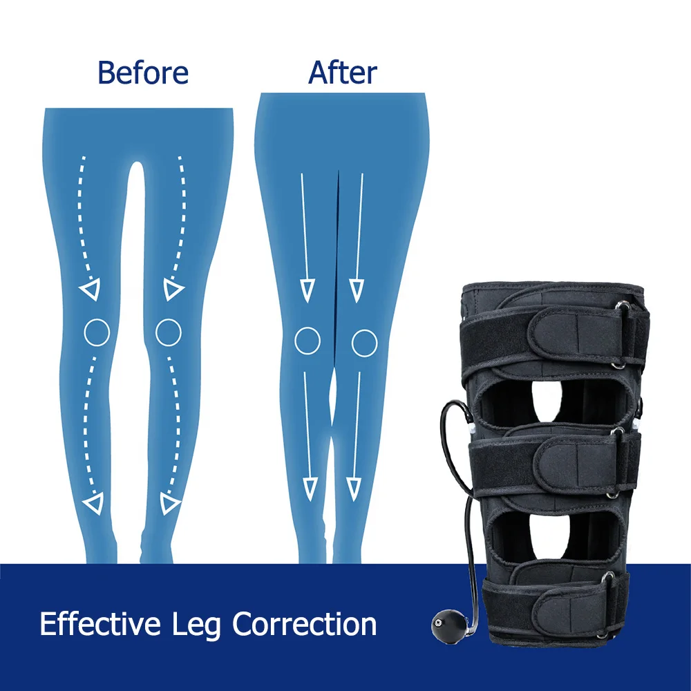 Leg Correction Band Belt O/X Type Bowed Legs Knee Valgum Straightening Posture Corrector Leg Band For Adults Children Adjustable