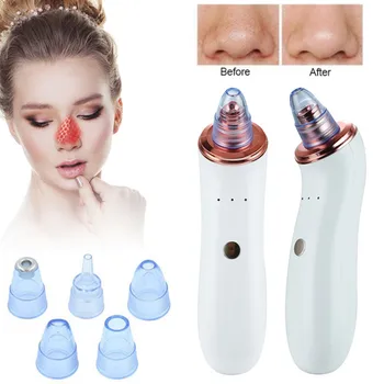 

USB Blackhead Remover Electric Acne Pore Vacuum Suction Treatment Pimple Removal Facial Nose Skin Care Machine Dropshipping