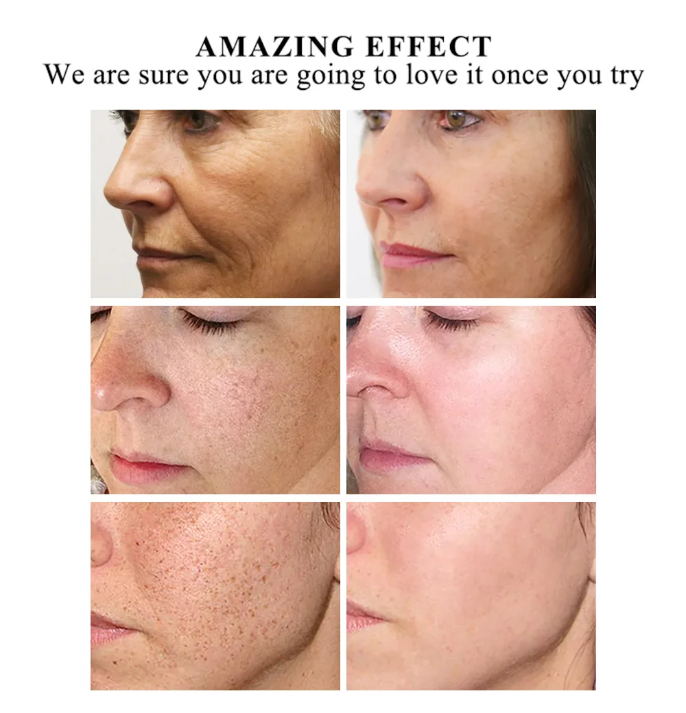 11124564436_130405746