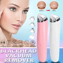 Вакуумный Электрический очищающий набор для лица от угрей, очиститель пор, машина для удаления угрей, инструмент для удаления угрей
