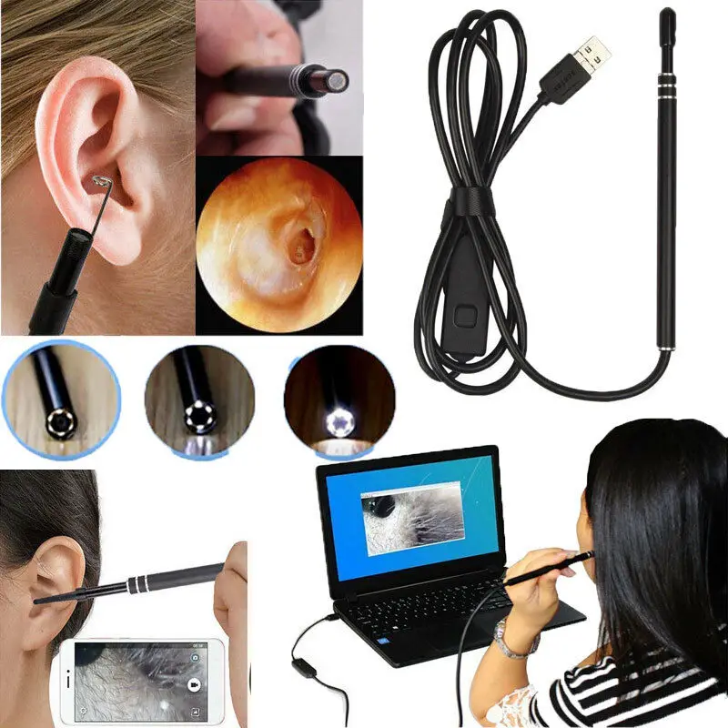 Ухочистка xiaomi. Пинцет для ушей с камерой. Смарт отоскоп luxmart. Эндоскоп с камерой ухо. Миникамера для уха.