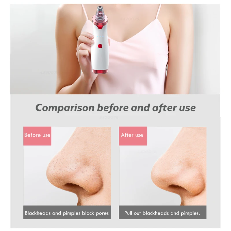 Blackhead Remover Face Deep Nose Cleaner T Zone Pore Acne Pimple Removal Vacuum Suction Facial Diamond Beauty Clean Skin Tool-2