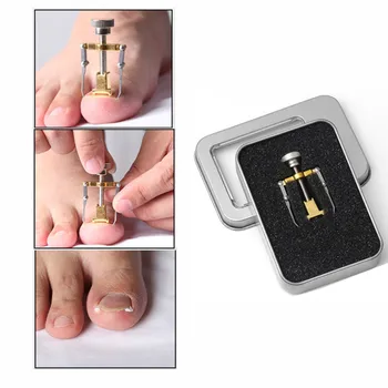 

Ingrown Toenail Corrector Pedicure Toenail Fixer Foot Nail Care Orthotic Stainless Steel Treatment Onyxis Bunion Correction Tool