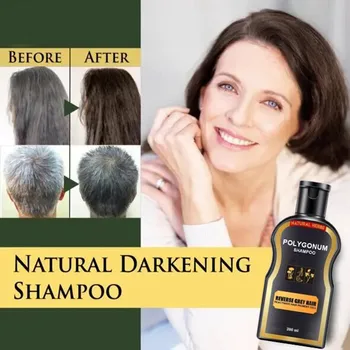 

Natural Darkening Shampoo Permanent Black Hair Shampoo Natural Ginger Coloring Conditions Prevents Hair Loss White Hair Cover Pe