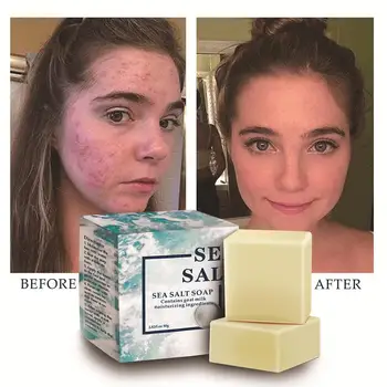 

80g Sea Salt Soap Handmade Whitening Soap Moisturizing Care Pores Wash Skin Removal Face Base Pimple Acne Treatment V6S1