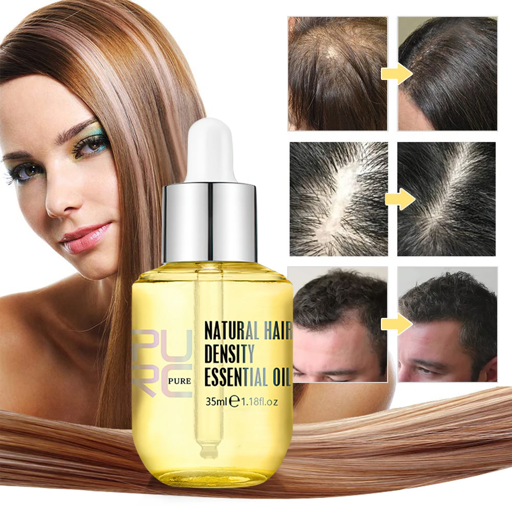 PURC productos el crecimiento del cabello para hombres y mujeres, esencia de jengibre, suero de aceite de crecimiento rápido, previene la pérdida de cabello, medicina el cuidado del cuero cabelludo|Productos