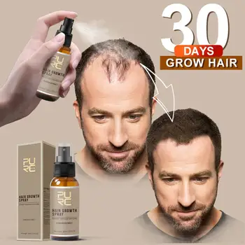 

30ml New Product 30ml Hair Care Treatment Hair Growth Spray Ginger Extract Prevent Hair Loss for Men & Women Repair hair fiber