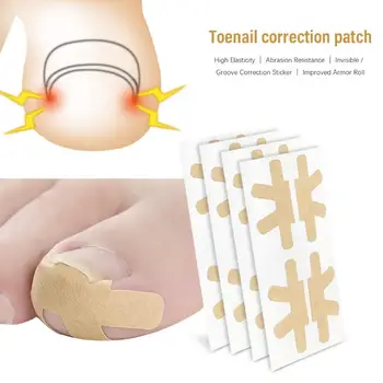 

4pcs/Sheet Ingrown Toenail Corrector Stickers Orthodontic Paronychia Treatment Recover Patches Toe Fingernail Care Tool