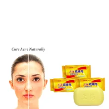 Экстракция растений китайское традиционное серное мыло для чистки угрей и удаления акне