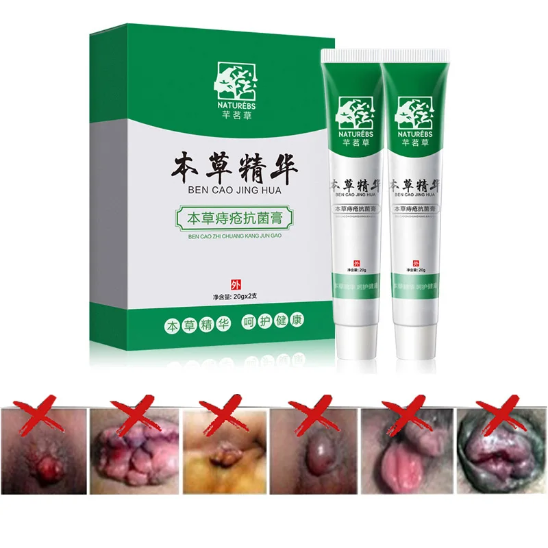 WXE Hemorrhoids Ointment Plant Herbal Materials Powerful Cream Internal Piles External Anal 2PCS |