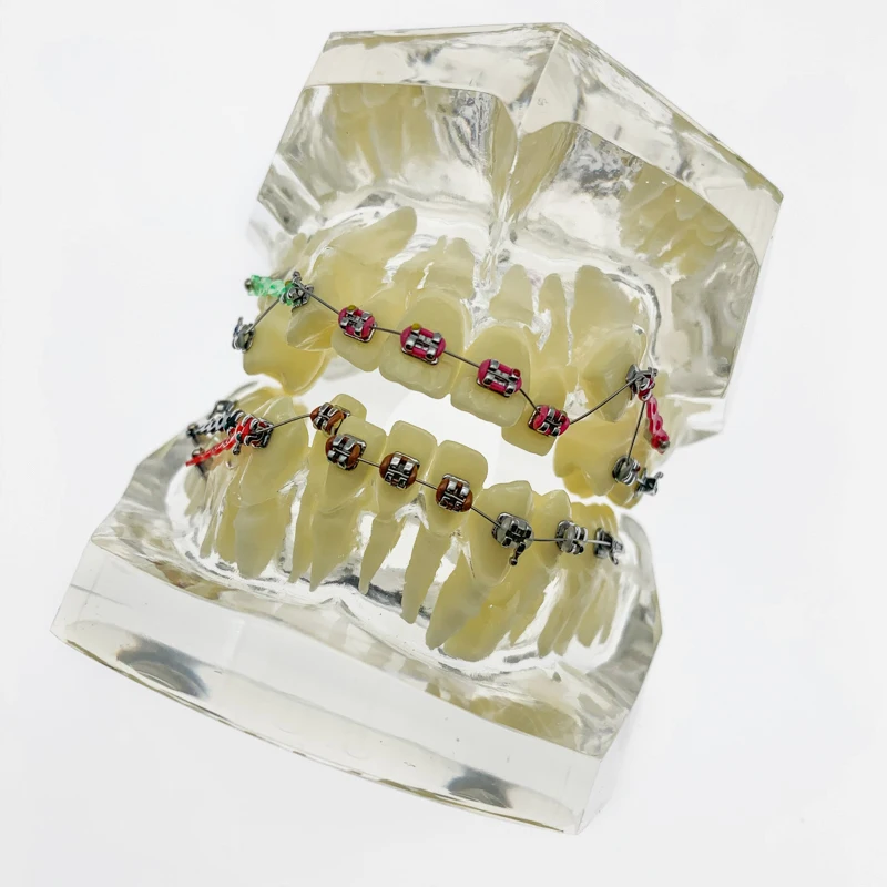 

Dental Teeth Models Are Used For Teaching And Hospital Dentist Material Malocclusion Orthodontic Model