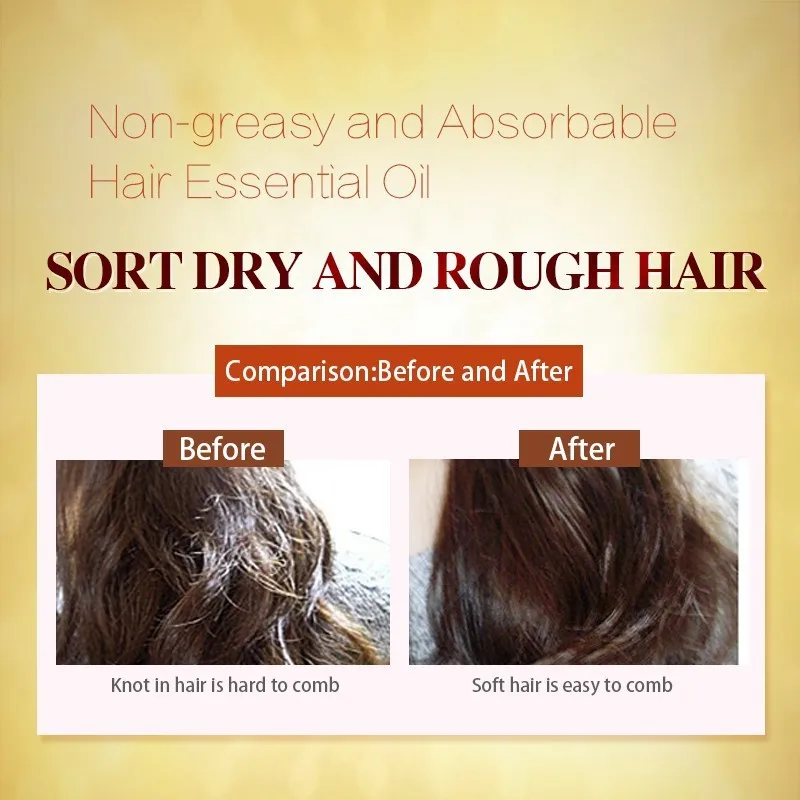 LAIKOU Moroccan Care Hair Essential Oil Scalp Treatment Moisturizing Hair Easily Absorbed Oils Increase The Gloss 1 LAIKOU Moroccan Care Hair Essential Oil Scalp Treatment Moisturizing Hair Easily Absorbed Oils Increase The Gloss 5