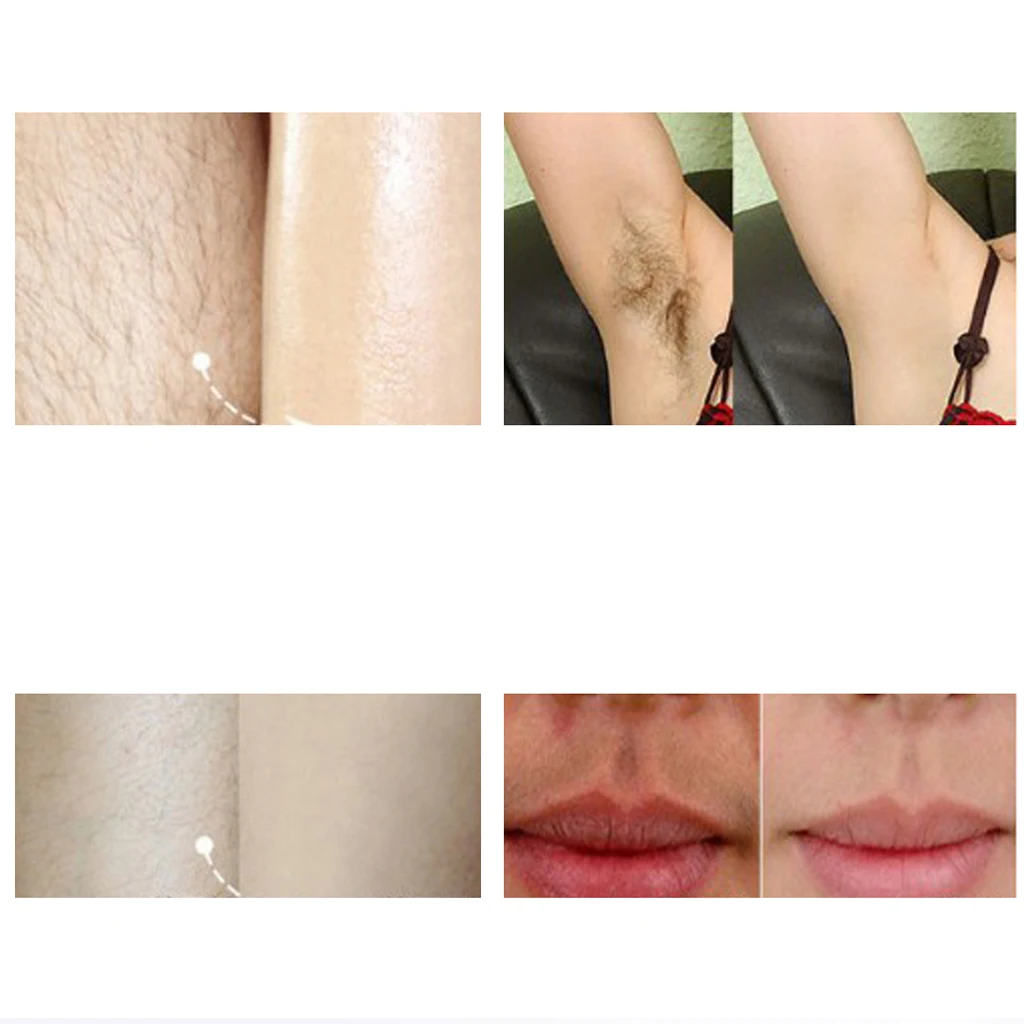 Women Electric Facial Body Hair Trimmer & Clipper for Eyebrows Nose Ear Eyebrow EU Plug KM-6637