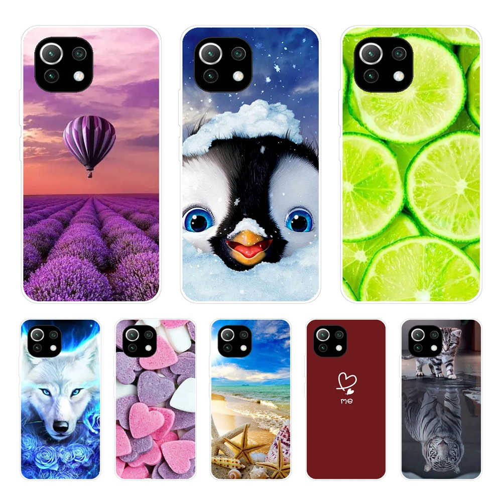 Per Xiaomi Mi 11 | Mi 11 Lite 5G 4G | Mi 11I Custodia Posteriore Per Xiaomi Mi 11 Ultra Phone Cover Silicon Funda Custodia In Tpu Nera