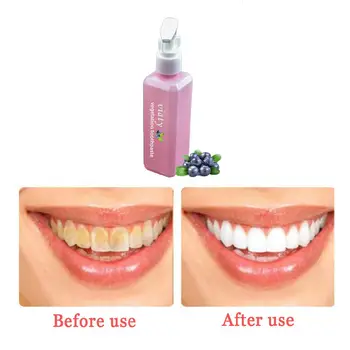 

Fexport 30/60/100ML Pressed Toothpaste Stain Removal Whitening Blueberry Toothpaste Fight Bleeding Gums Teeth Whitening Tool