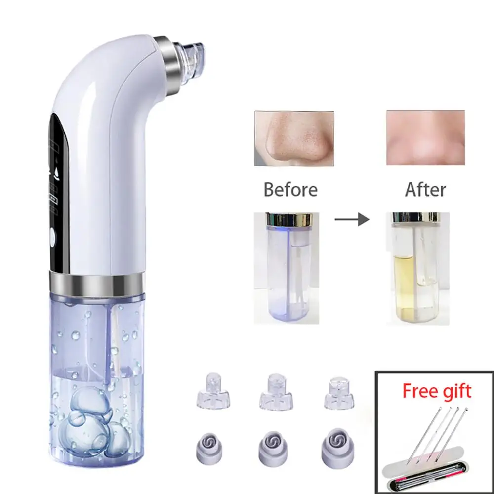 Comedondrukker Pore Stofzuiger Verbeterde Mee-eter Vacuüm Oplaadbare Gezicht Vacuüm Comedo Extractor Tool Voor Mee-eter