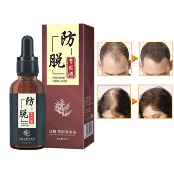 

Hot Anti-hair Loss Shampoo Fast Grow Ginger Shampoo Ginger King Shampoo Antidandruff Shampoo
