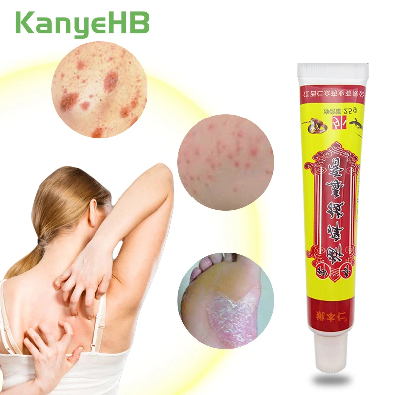

1pcs Psoriasis Ointment Feet Rotten Peeling Itching Blisters Foot Corn Cream Pain Relief Natural Herbal Medical Plaster S009