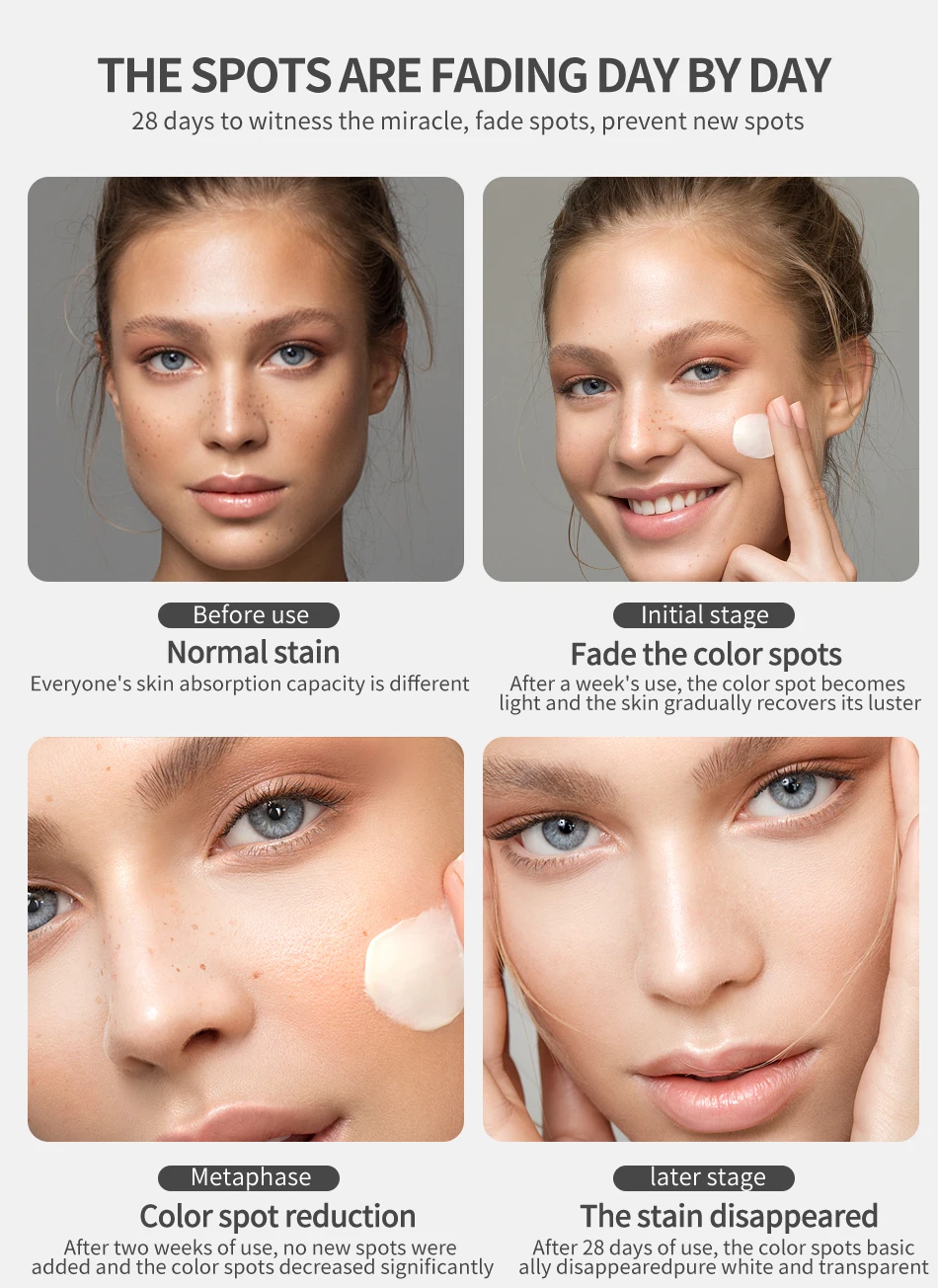 Remover manchas escuras Melasma Melanina Bright Face Coréia Cuidados com a pele