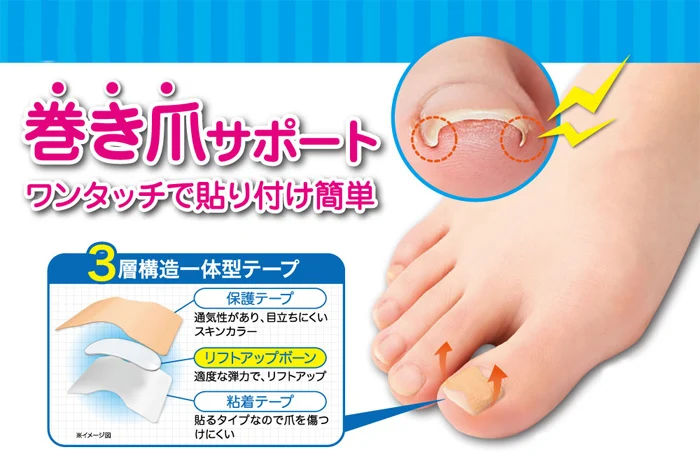 Новый двусторонний скотч для вросших ногтей коррекция набор инструментов