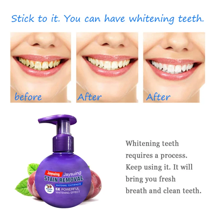 Интенсивный пятновыводитель отбеливающая зубная паста против кровотечения десен с зубной щеткой для чистки зубов E2S