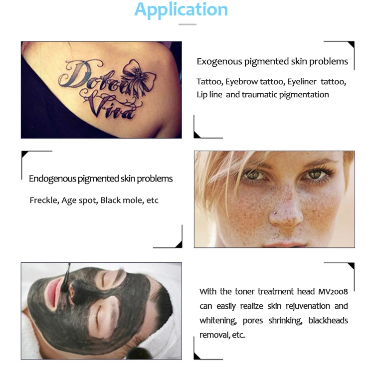 HONKON Q switched nd yag laser tattoo removal machine mv2008