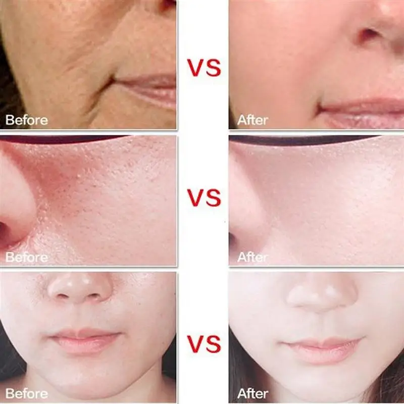 HTB1G9aOQpXXXXb4XXXXq6xXFXXXx