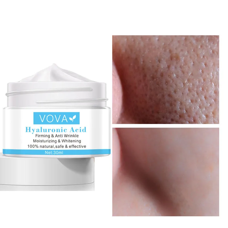 VOVA 30g Hyaluronic Acid Face Cream Serum Anti Aging Anti-Wrinkle Shrink Pores Moisturizing Facial for Skin Whitening Day |