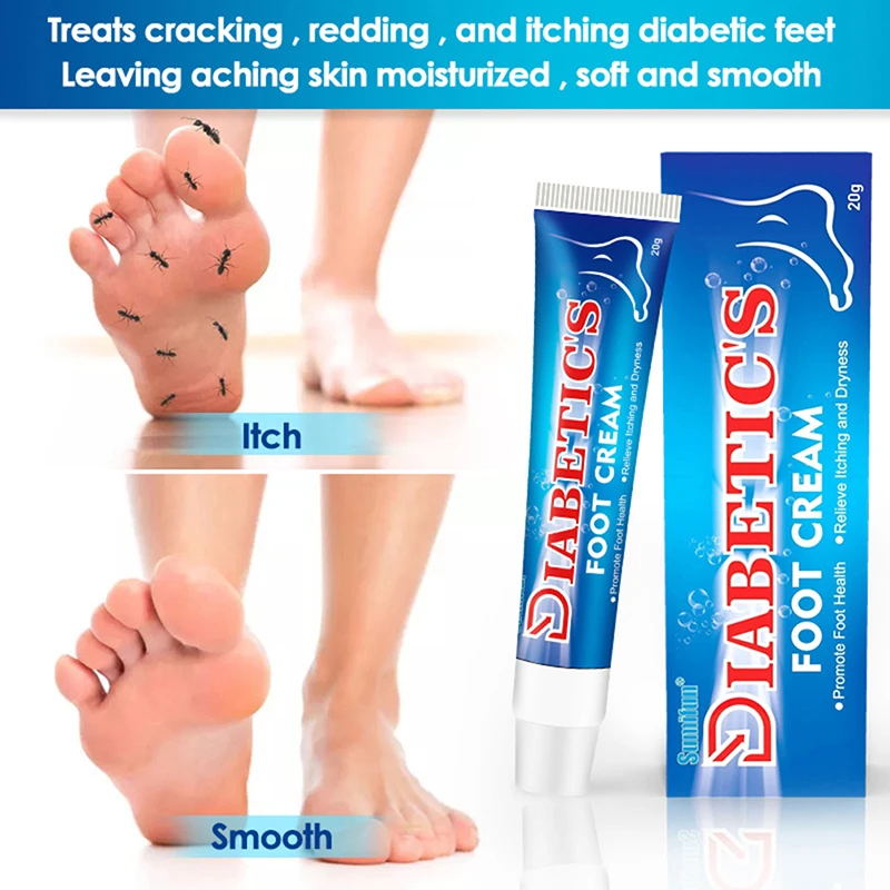 20g Diabetic Cream For Foot Care Toe 