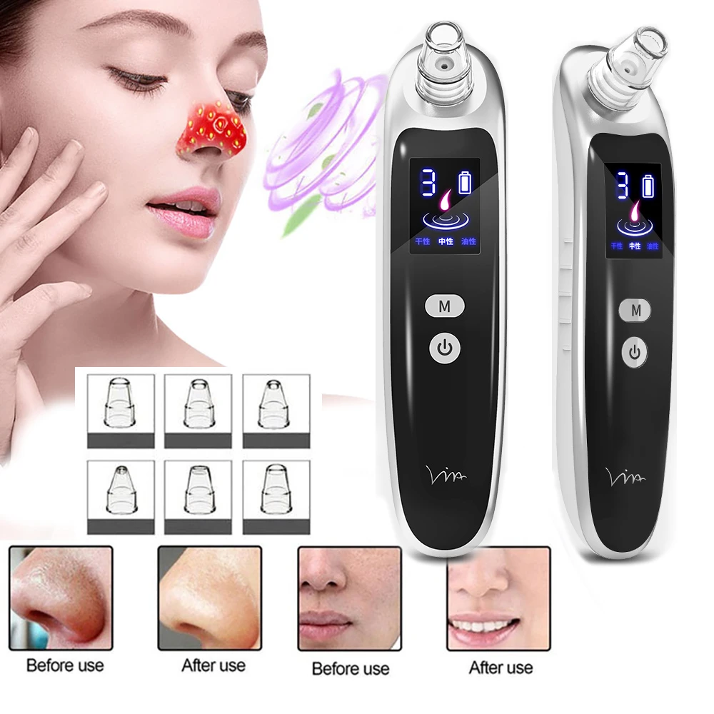 stratum corneum blackhead removal