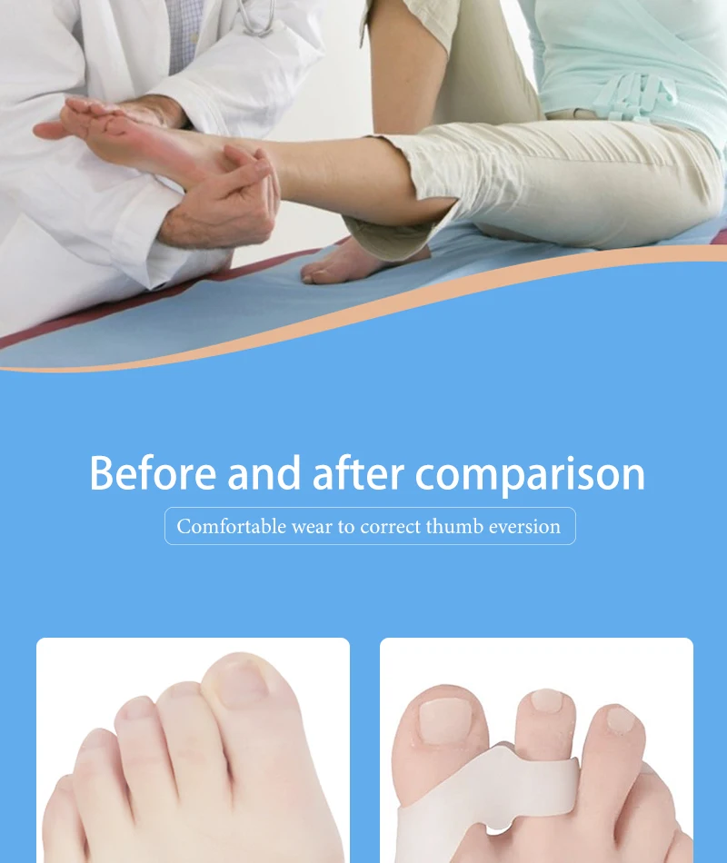 Silikon-Gel-Daumenkorrektor, Hallux-Valgus-Schutz für den kleinen Zeh, Zehenspreizer, Fingerkorrektor, Fußpflege, Schmerzlinderungspolster, Werkzeug – Detail 6