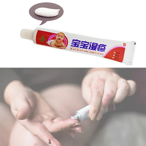 1pcs Baby Eczema Cream Psoriasis Pruritus Dermatitis Itching Repair Skin Chinese Herbal Medical Plaster Ointment S011