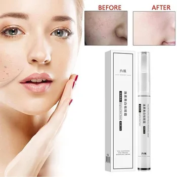 

Spots And Tags Remover Serum Pigment Corrector Whitening Pen Face Freckle Remove Anti Acne Scar Spots Melanin Blemish Cream