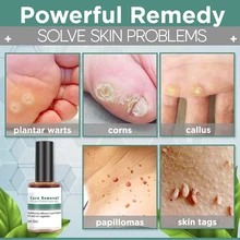 

10ml Wart Remover Serum Corn Removal Extra Strengthen Gel Corn Warts Remover Skin Tag Remover Corn Antibacterial Skin Care TSLM1