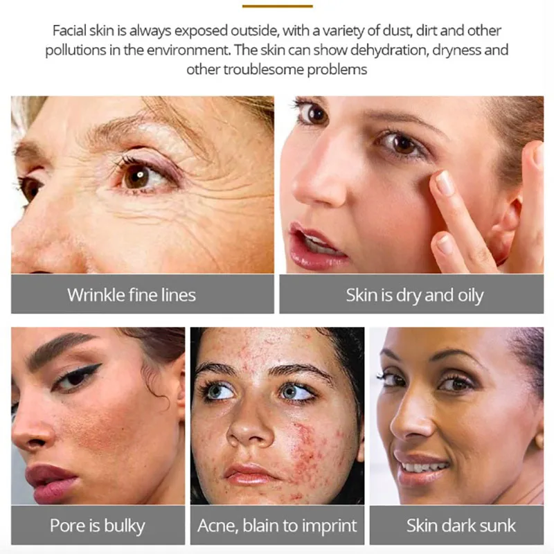 Новый корейский улитка Золотой дневной крем для лица лечение акне увлажнение