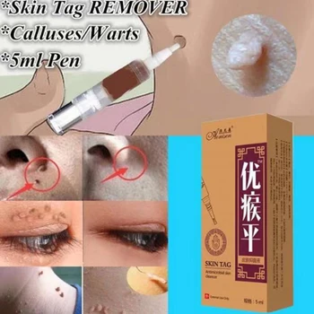 

5ml Mole & Skin Tag Repair Solution Painless Mole Skin Dark Spot Repair Face Wart Tag Freckle Repair Cream Oil Dropshipping D238